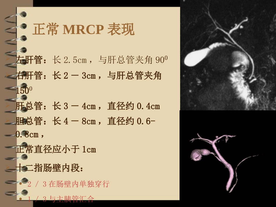 胆道梗阻的影像学诊断_第9页