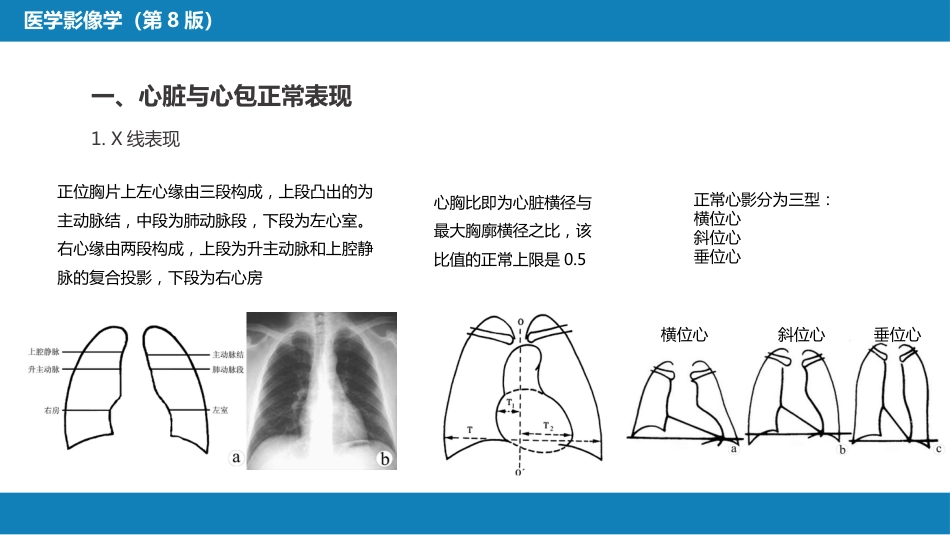 第五章 循环系统 第一节 检查技术；第二节 正常影像表现_第14页