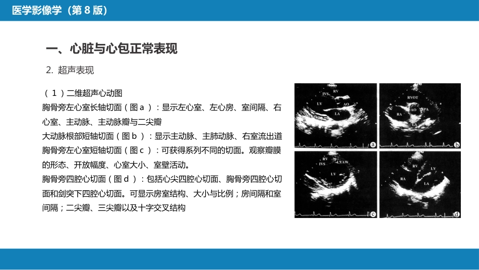 第五章 循环系统 第一节 检查技术；第二节 正常影像表现_第15页