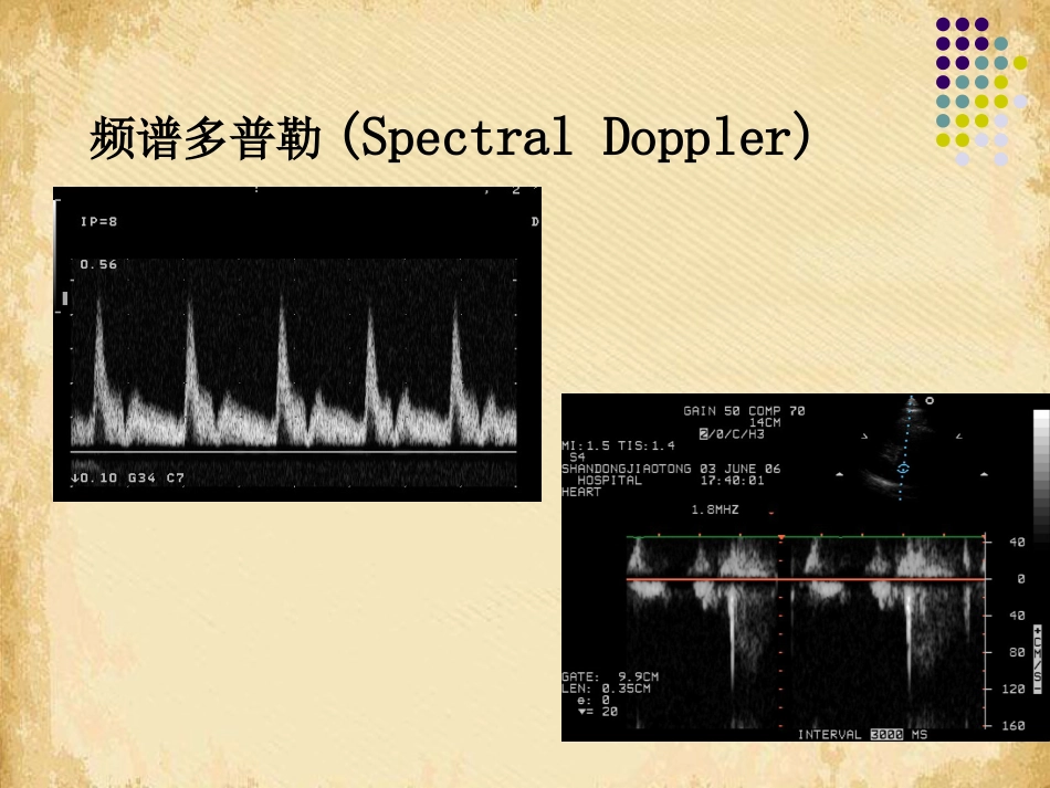 超声影像学概述_第12页