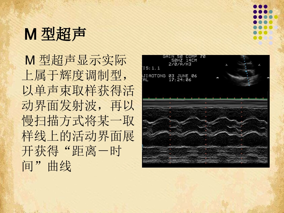 超声影像学概述_第6页