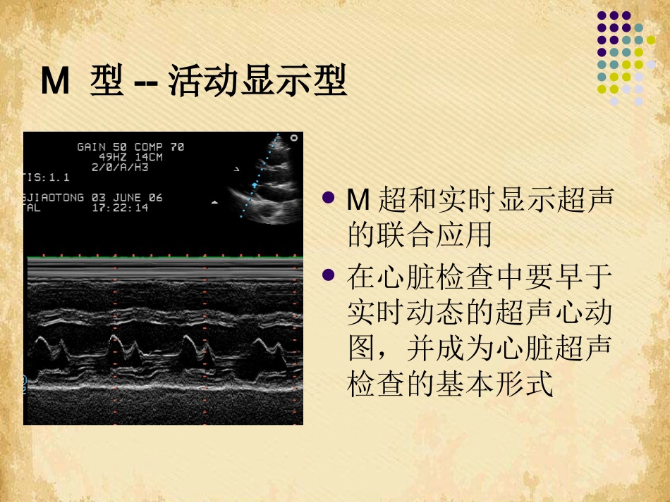 超声影像学概述_第7页