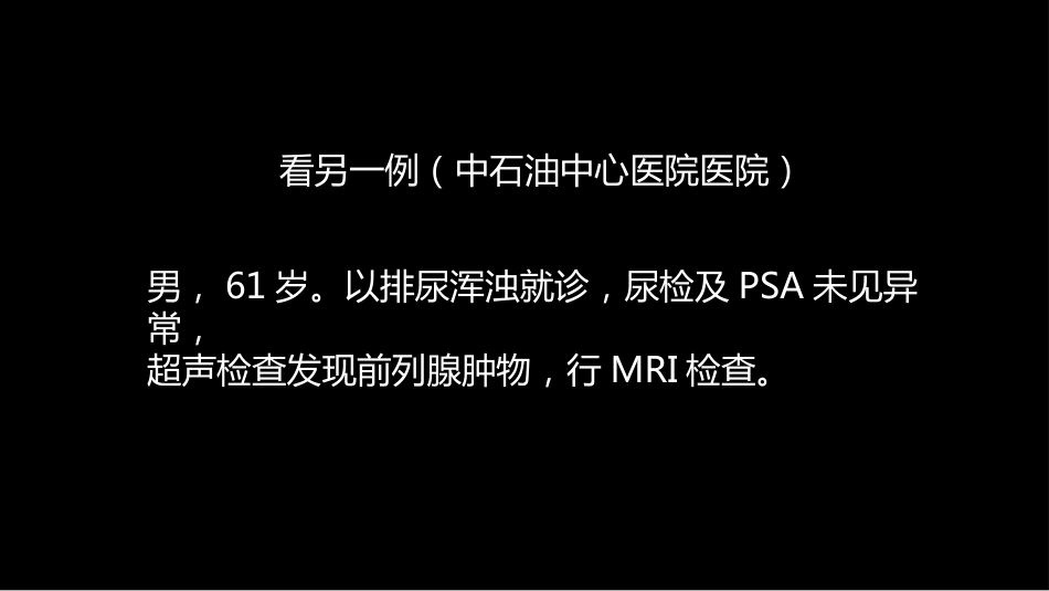 异位前列腺误诊为肿瘤_第10页