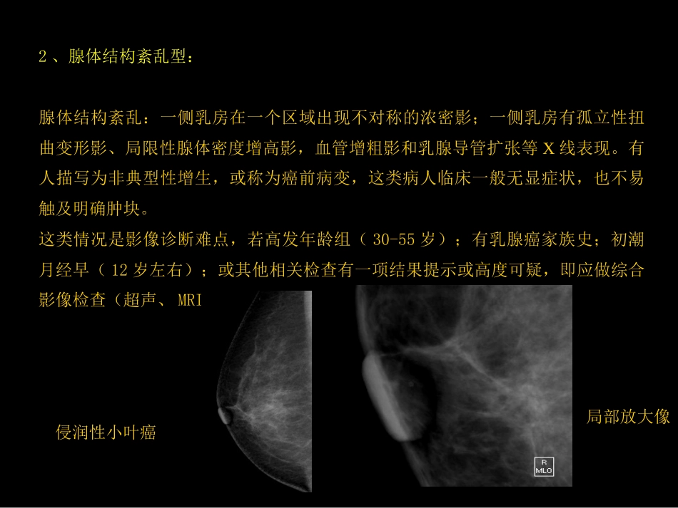 乳腺癌早期影像检查_第9页