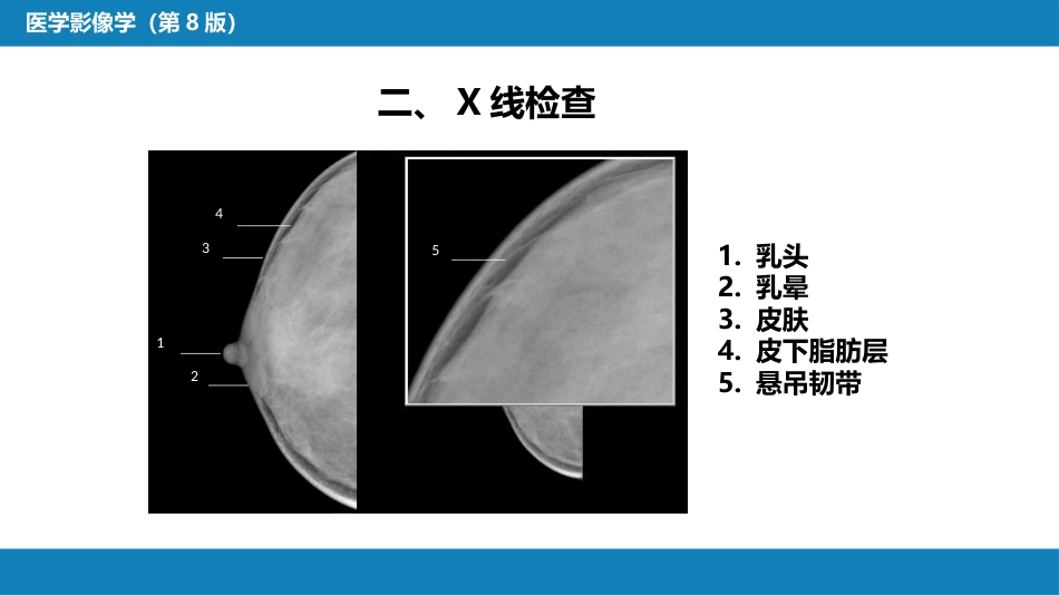 第六章 乳腺_第14页