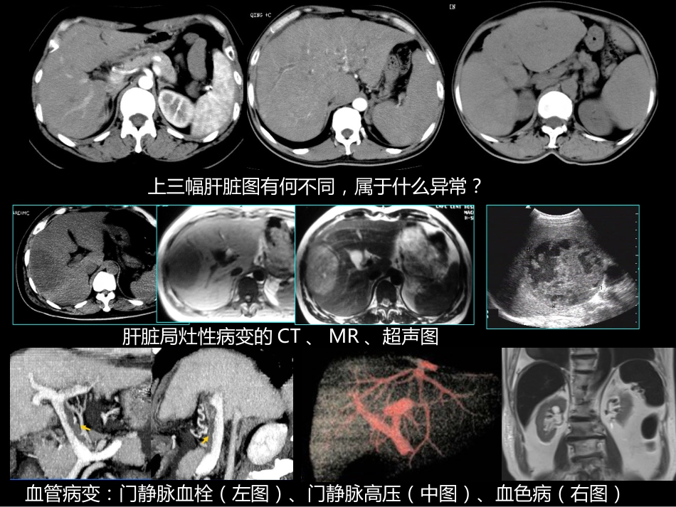 肝胆胰影像学诊断_第11页