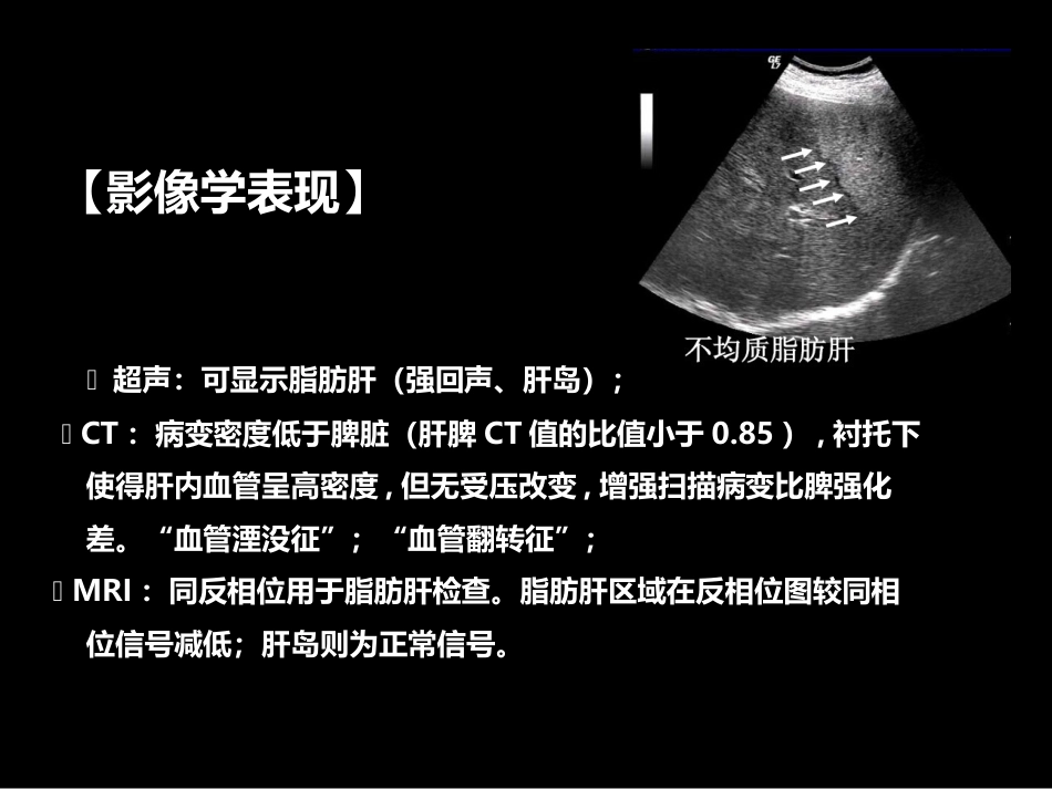 肝胆胰影像学诊断_第14页