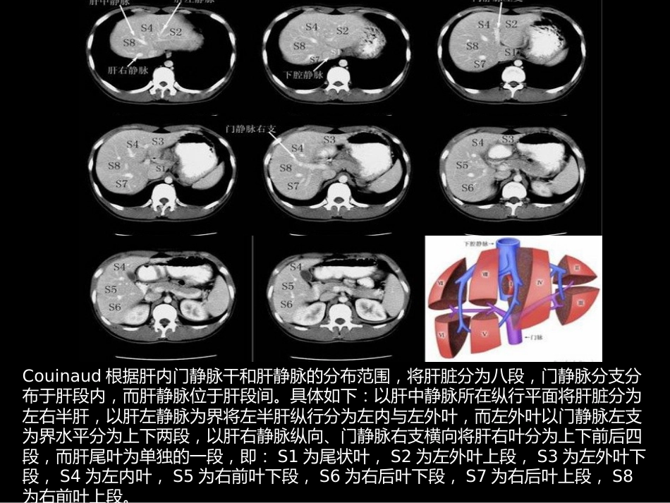肝胆胰影像学诊断_第7页