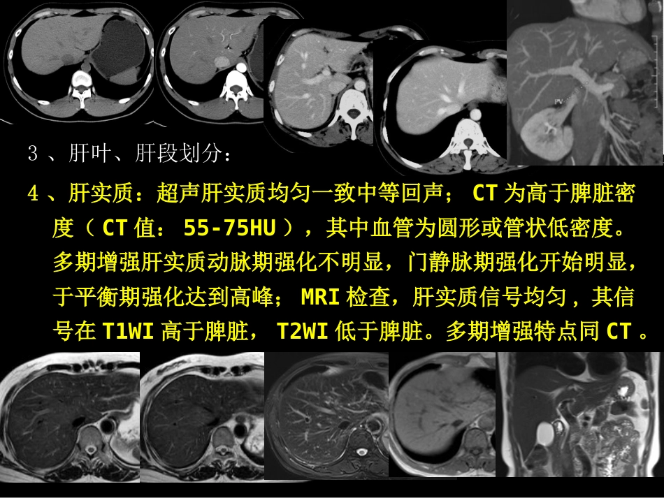 肝胆胰影像学诊断_第8页