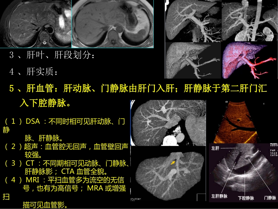 肝胆胰影像学诊断_第9页