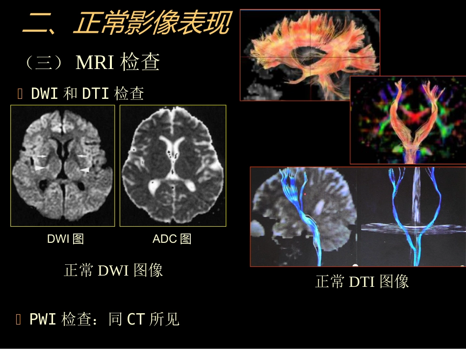 中枢神经(脑、脊髓)影像诊断_第14页