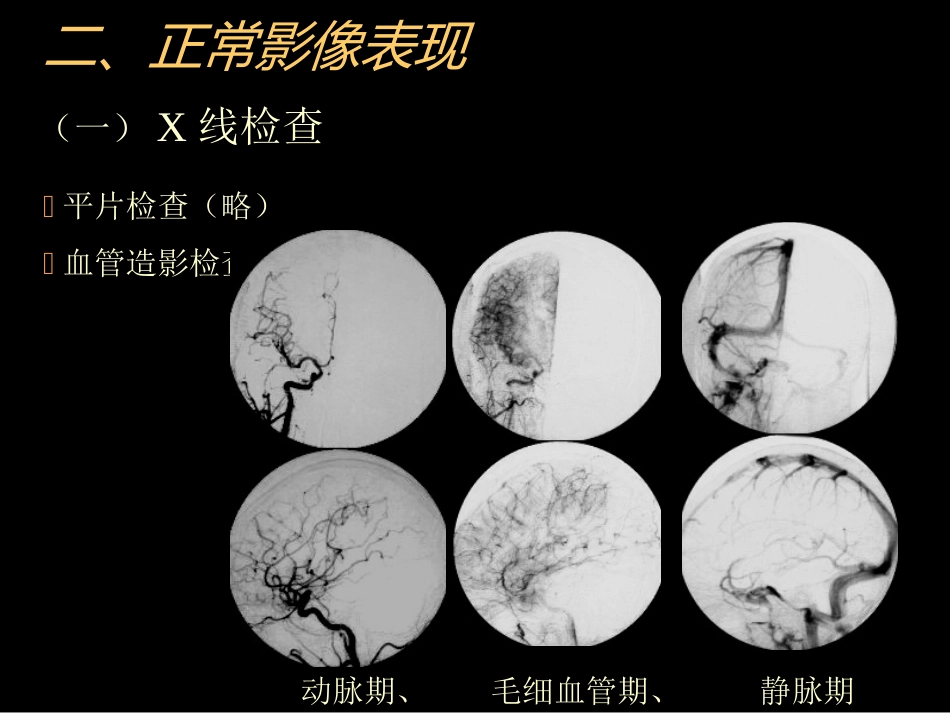 中枢神经(脑、脊髓)影像诊断_第5页