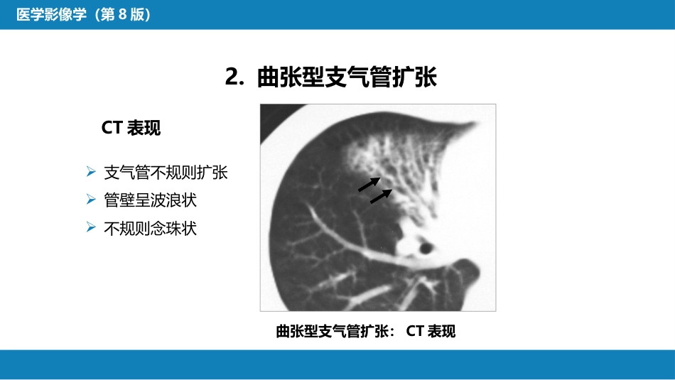 第四章 呼吸系统 第四节 疾病诊断-支气管扩张症、肺炎_第14页