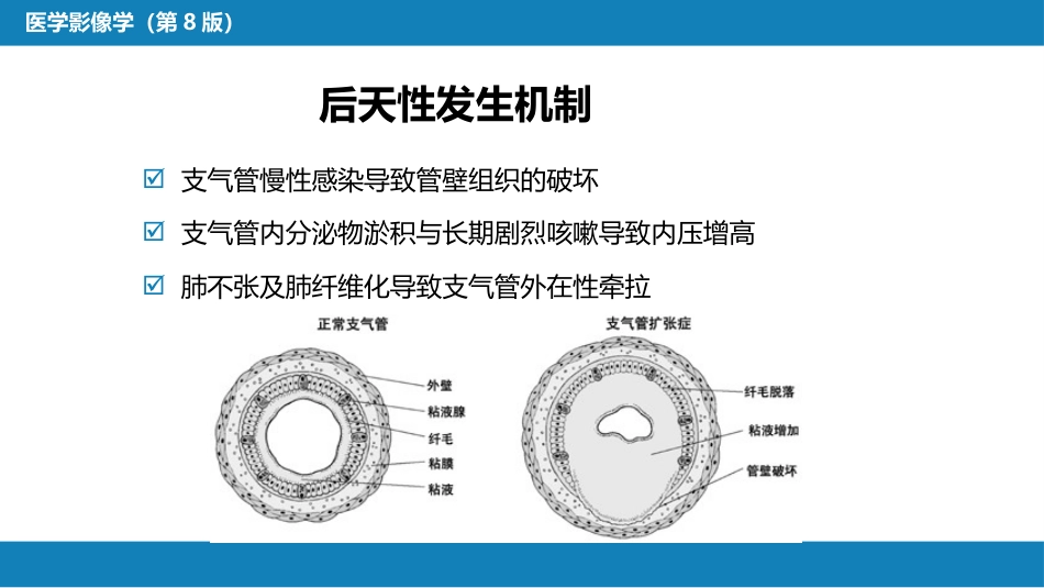 第四章 呼吸系统 第四节 疾病诊断-支气管扩张症、肺炎_第6页