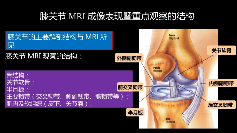 膝关节损伤：MR图像解读_第6页