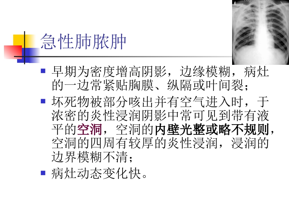 大叶性肺炎的影像诊断_第13页