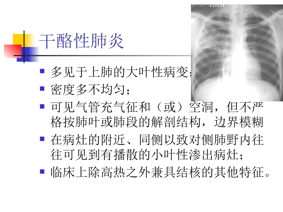 大叶性肺炎的影像诊断_第15页