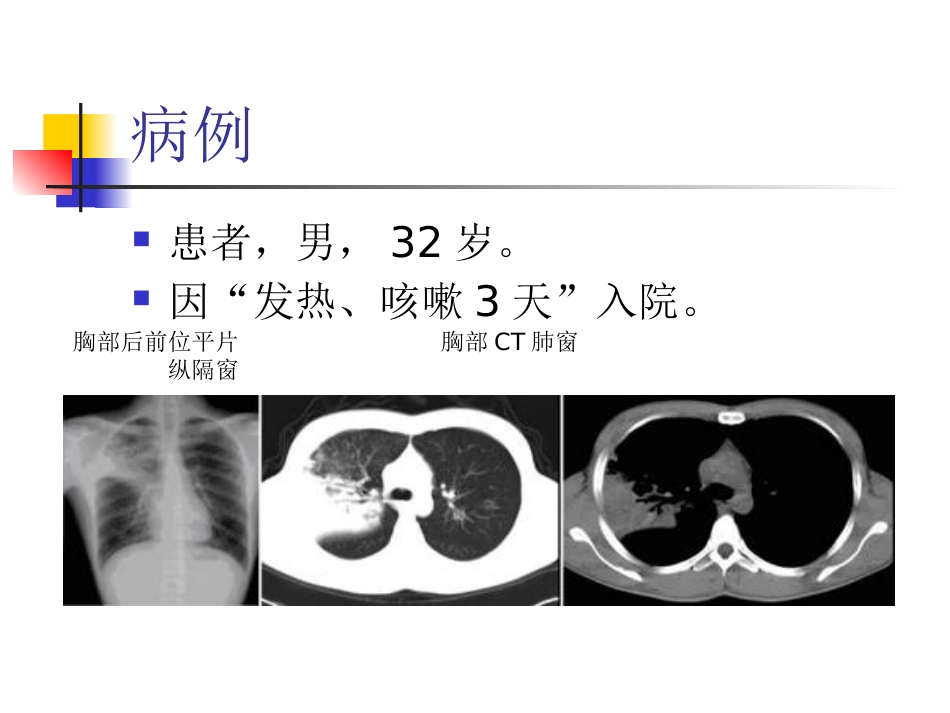 大叶性肺炎的影像诊断_第2页