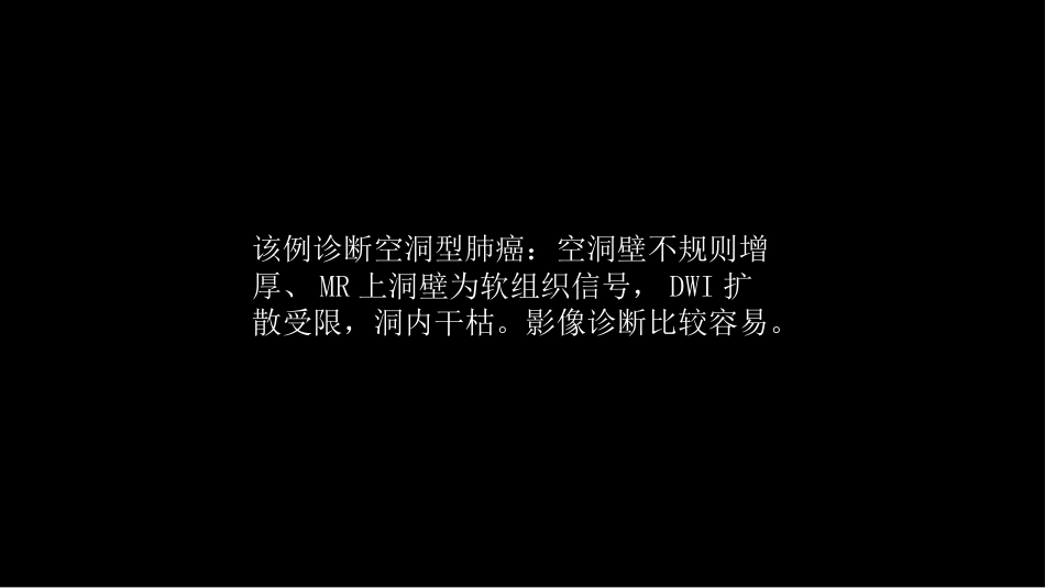 肺部空洞性病变CT与MRI_第9页