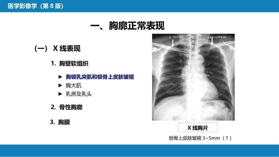第四章 呼吸系统 第一节 检查技术；第二节 正常影像表现_第13页