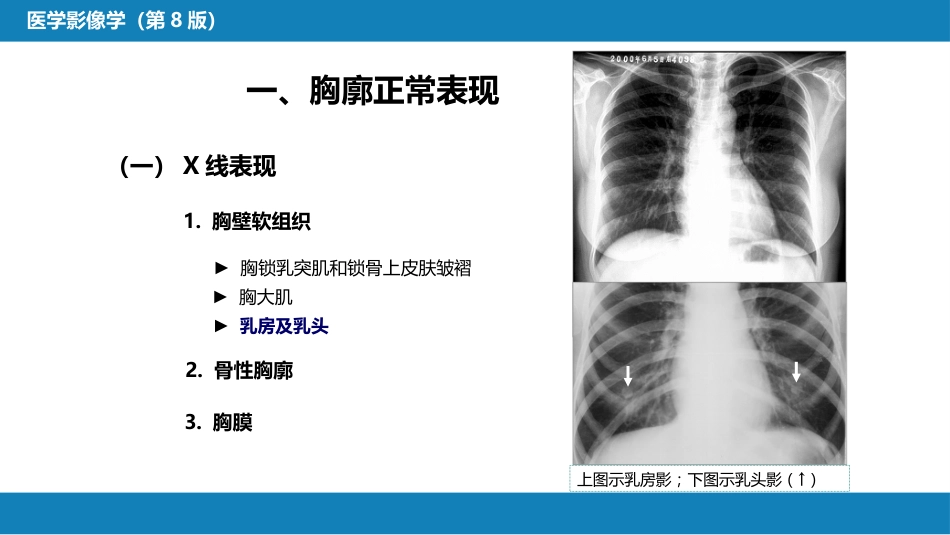第四章 呼吸系统 第一节 检查技术；第二节 正常影像表现_第14页