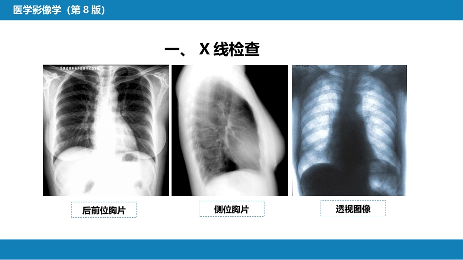 第四章 呼吸系统 第一节 检查技术；第二节 正常影像表现_第7页