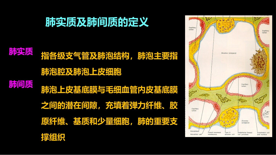 肺部影像学部分病理征象解读_第4页