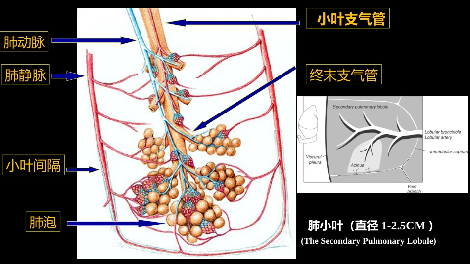 肺部影像学部分病理征象解读_第6页