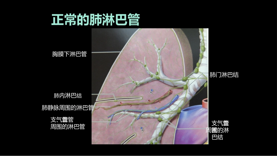 肺部影像学部分病理征象解读_第7页