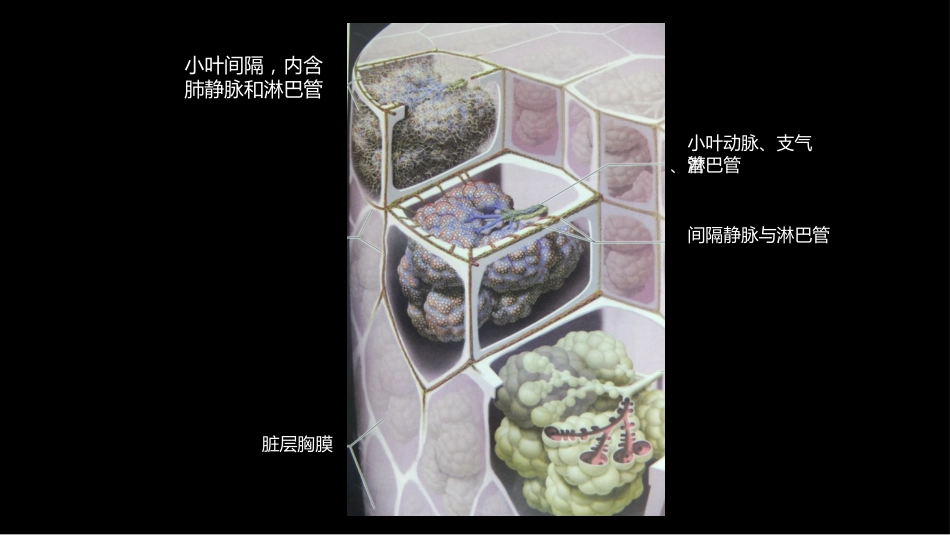 肺部影像学部分病理征象解读_第8页