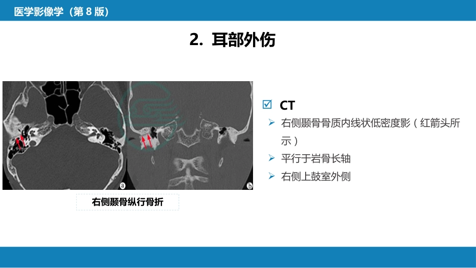 第三章 头颈部_第14页