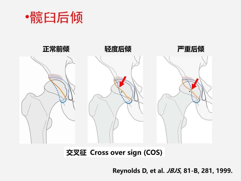 成人正常髋关节影像学_第15页