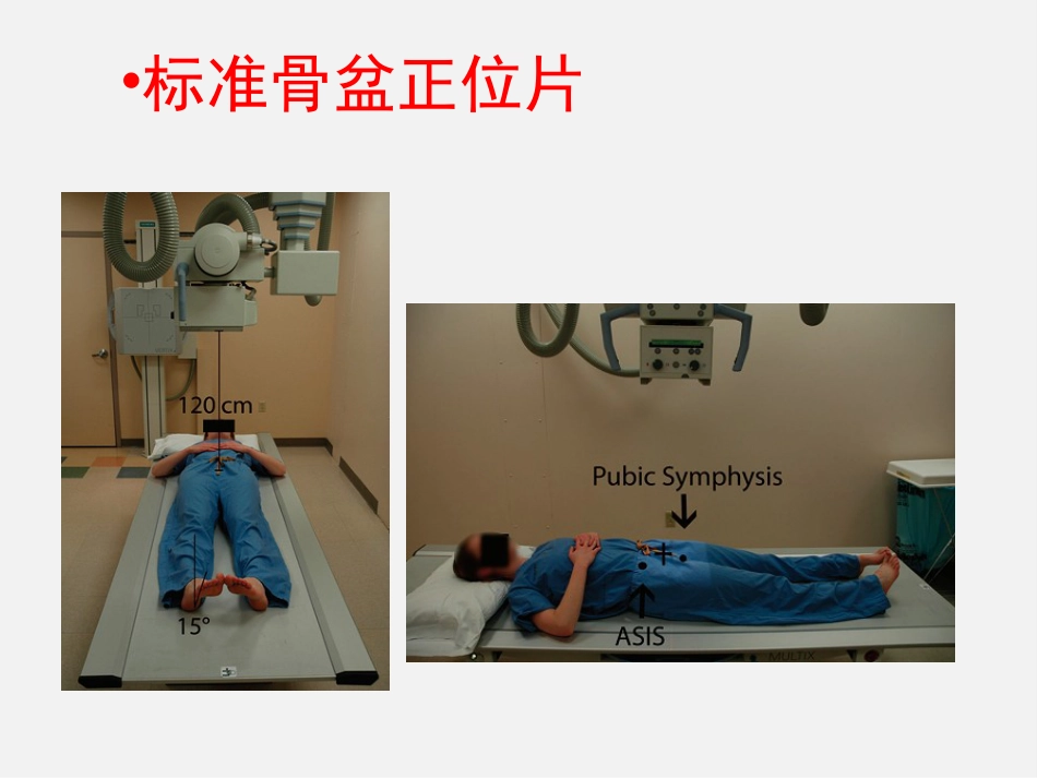 成人正常髋关节影像学_第4页