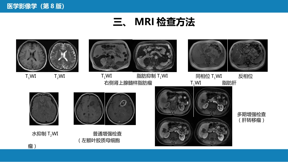 第一章 影像诊断学总论 第四节 磁共振成像_第6页