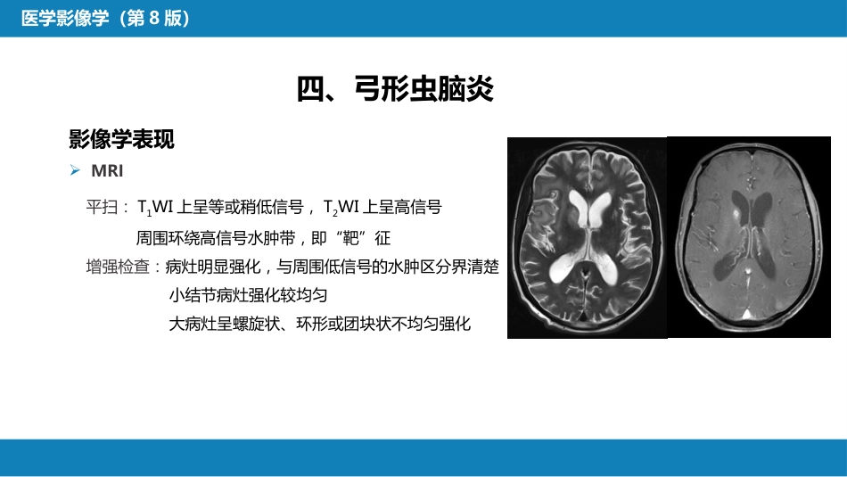 第十一章 传染性疾病_第12页