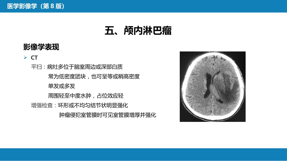 第十一章 传染性疾病_第13页