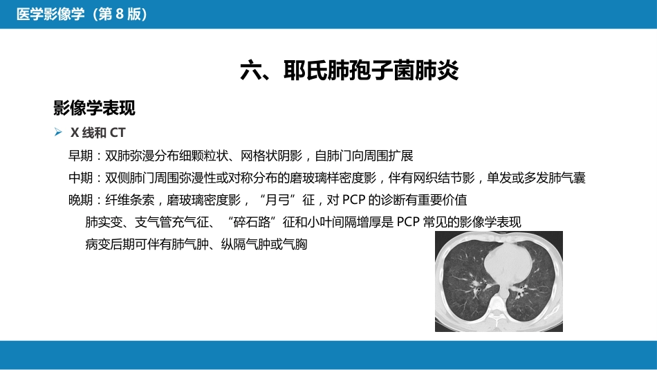 第十一章 传染性疾病_第15页