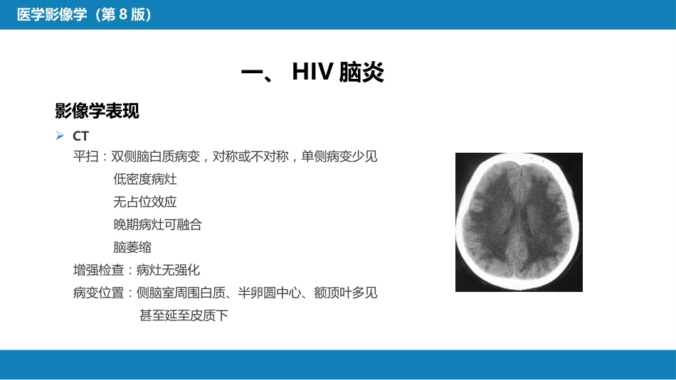 第十一章 传染性疾病_第5页