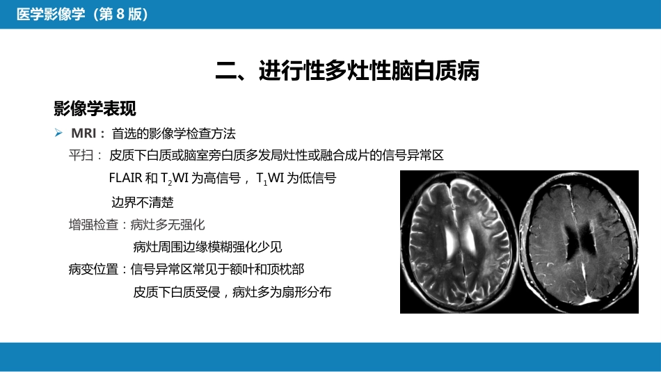 第十一章 传染性疾病_第8页