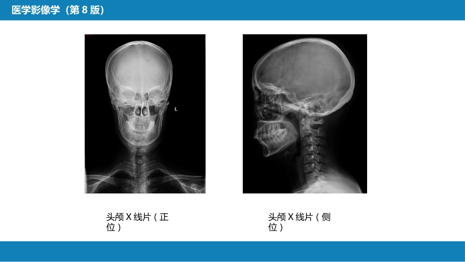 第二章 中枢神经系统 第一节 检查技术_第10页