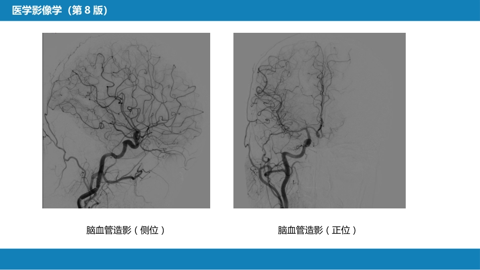 第二章 中枢神经系统 第一节 检查技术_第11页