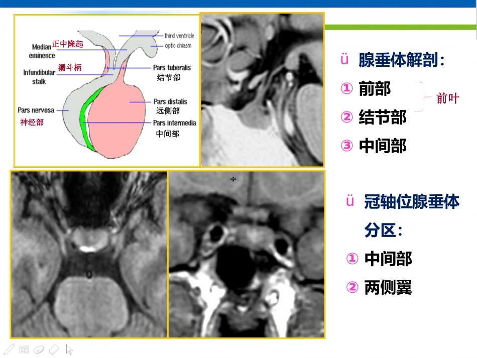 垂体病变的影像学诊断规范_第10页