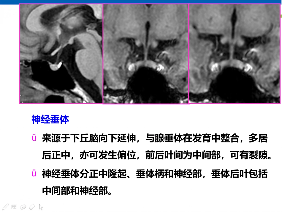 垂体病变的影像学诊断规范_第12页