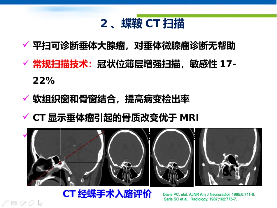 垂体病变的影像学诊断规范_第4页