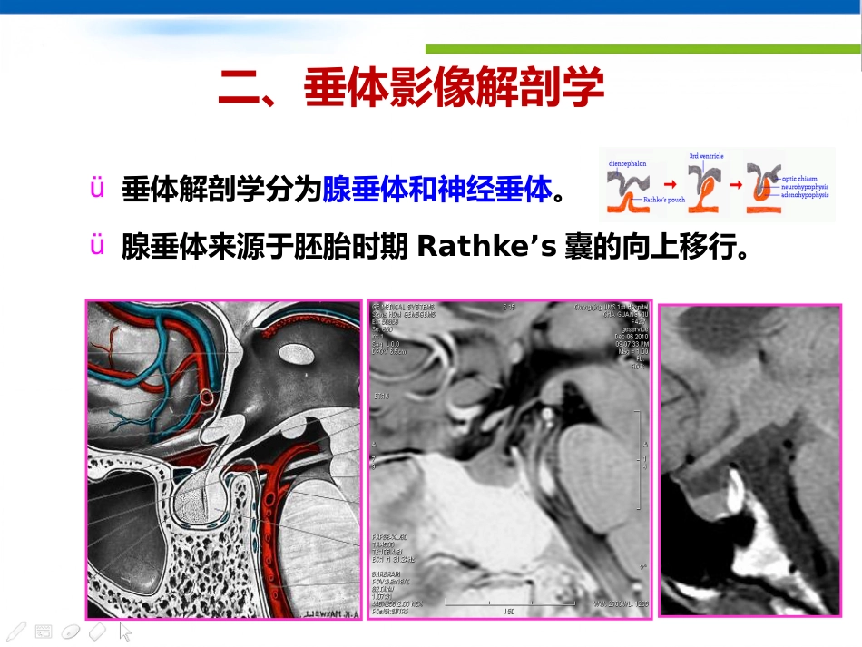 垂体病变的影像学诊断规范_第8页
