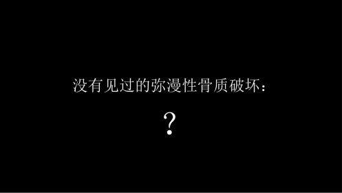 没有见过的弥漫性的骨质破坏