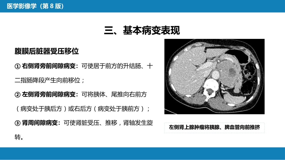 第八章 泌尿生殖系统与腹膜后间隙 第五节 腹膜后间隙_第10页