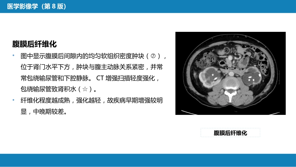 第八章 泌尿生殖系统与腹膜后间隙 第五节 腹膜后间隙_第15页
