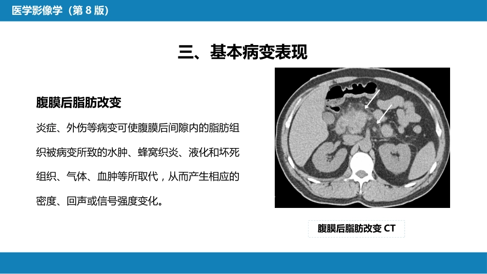 第八章 泌尿生殖系统与腹膜后间隙 第五节 腹膜后间隙_第7页