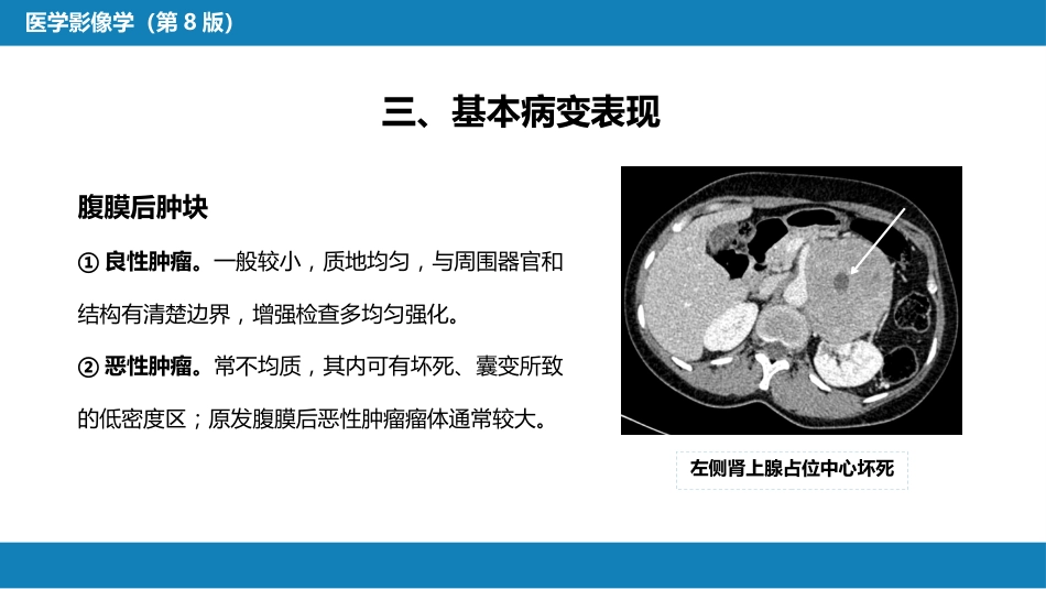 第八章 泌尿生殖系统与腹膜后间隙 第五节 腹膜后间隙_第8页